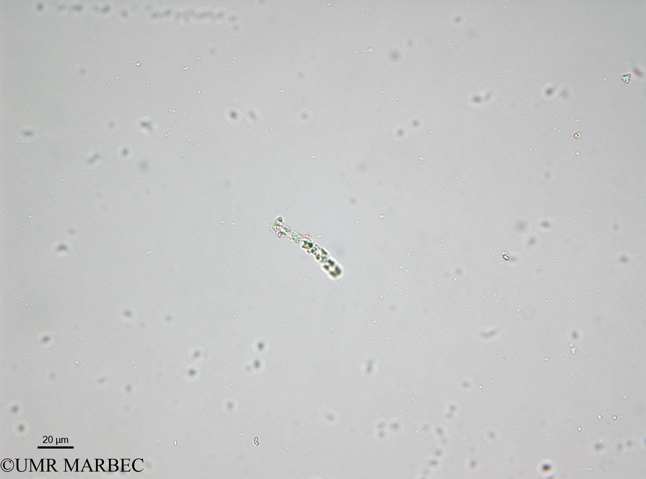 phyto/Bizerte/bizerte_lagoon/RISCO April 2014/Dactyliosolen sp (- 140730_001_ovl-2).tif(copy).jpg